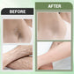 🔥🔥Achetez 3  obtenez 2 gratuit🎁 Set de crème dépilatoire 3PCS pour le corps entier